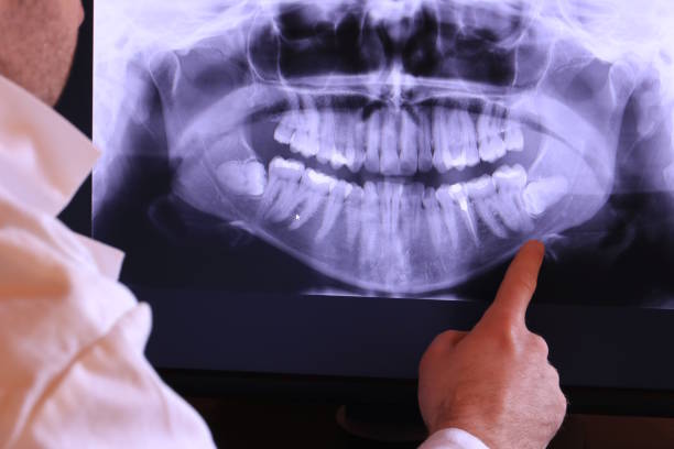 Best Walk-In Emergency Dentist in Hermann, MO
